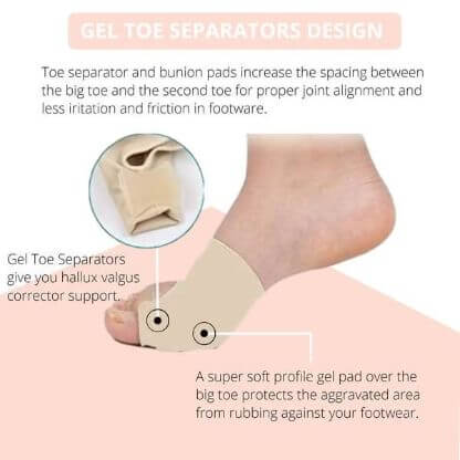 FIXEDFEET_TY